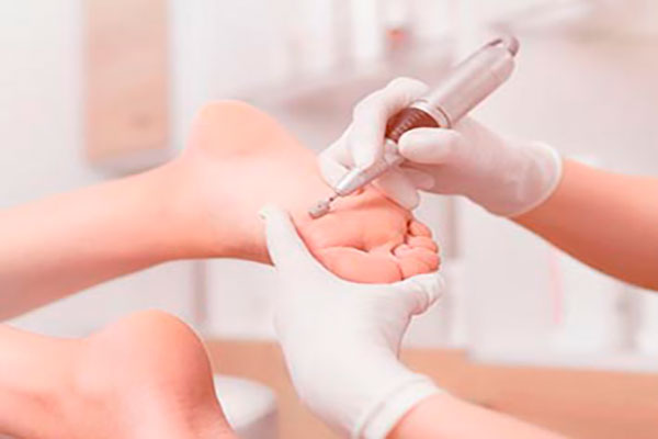 Tratamento para pés diabéticos